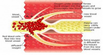BÀI 2. CÁC LOẠI BUỒNG ĐIỀU TRỊ OXY CAO ÁP HIỆN NAY